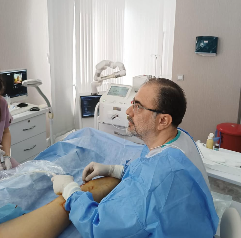 Non-Surgical Varicose Vein Treatment