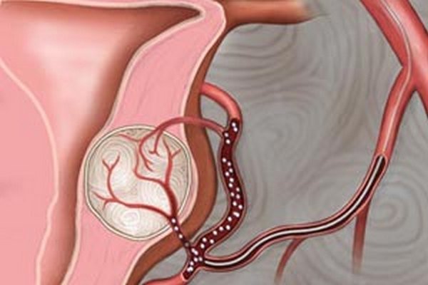 Non-Surgical Cancer Treatments