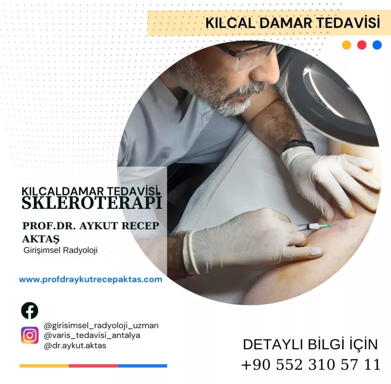 Ameliyatsız Varis Tedavisi Antalya